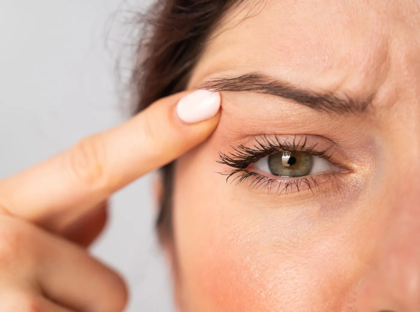 Indicaciones para blefaroplastia - exceso de piel y bolsas