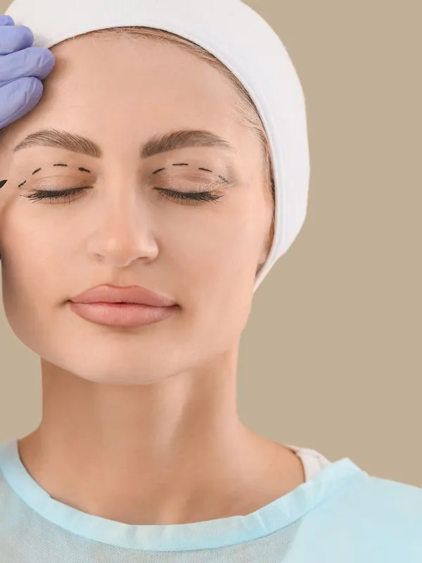 Blefaroplastia