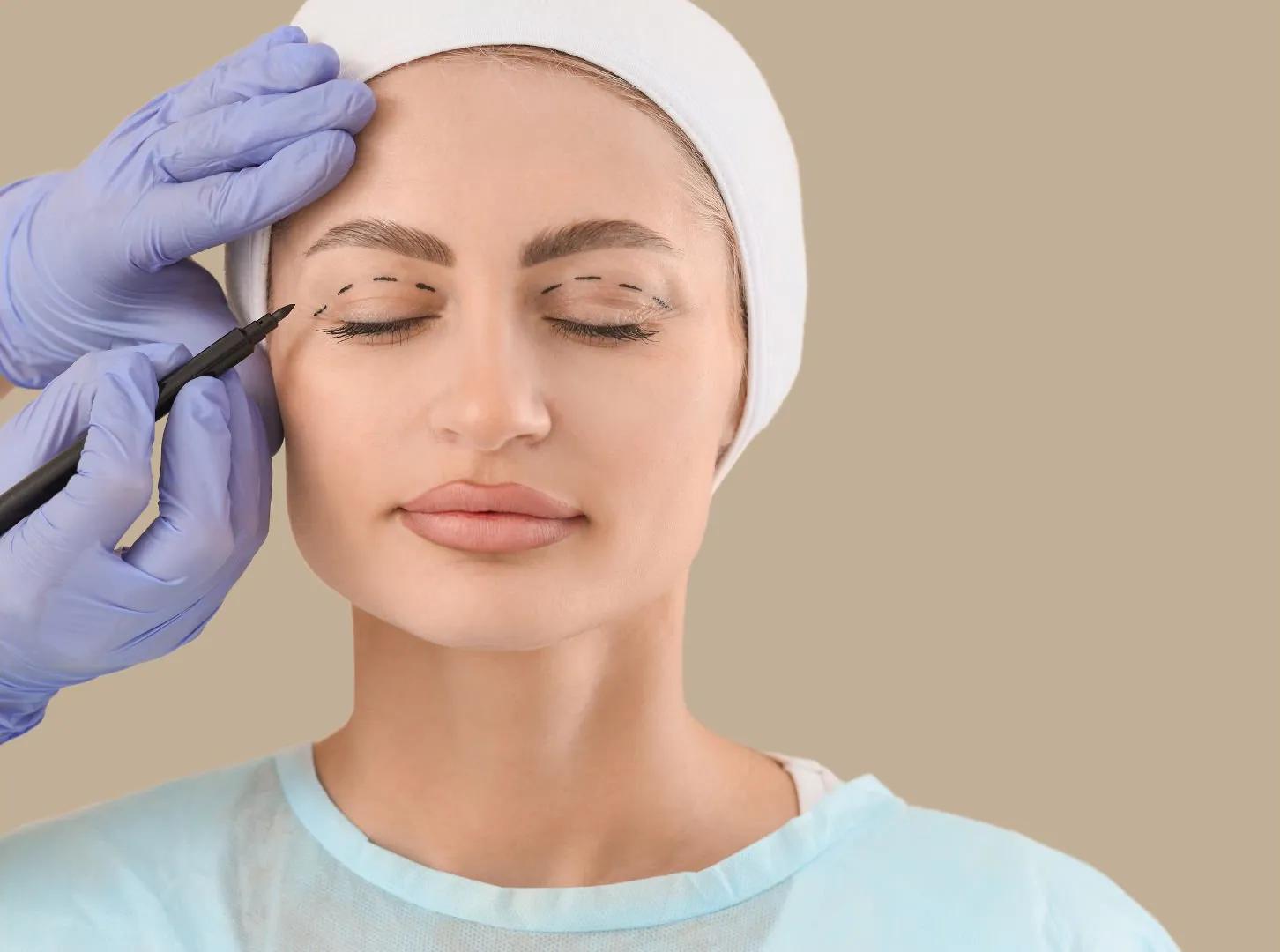 Procedimiento de blefaroplastia - antes y después